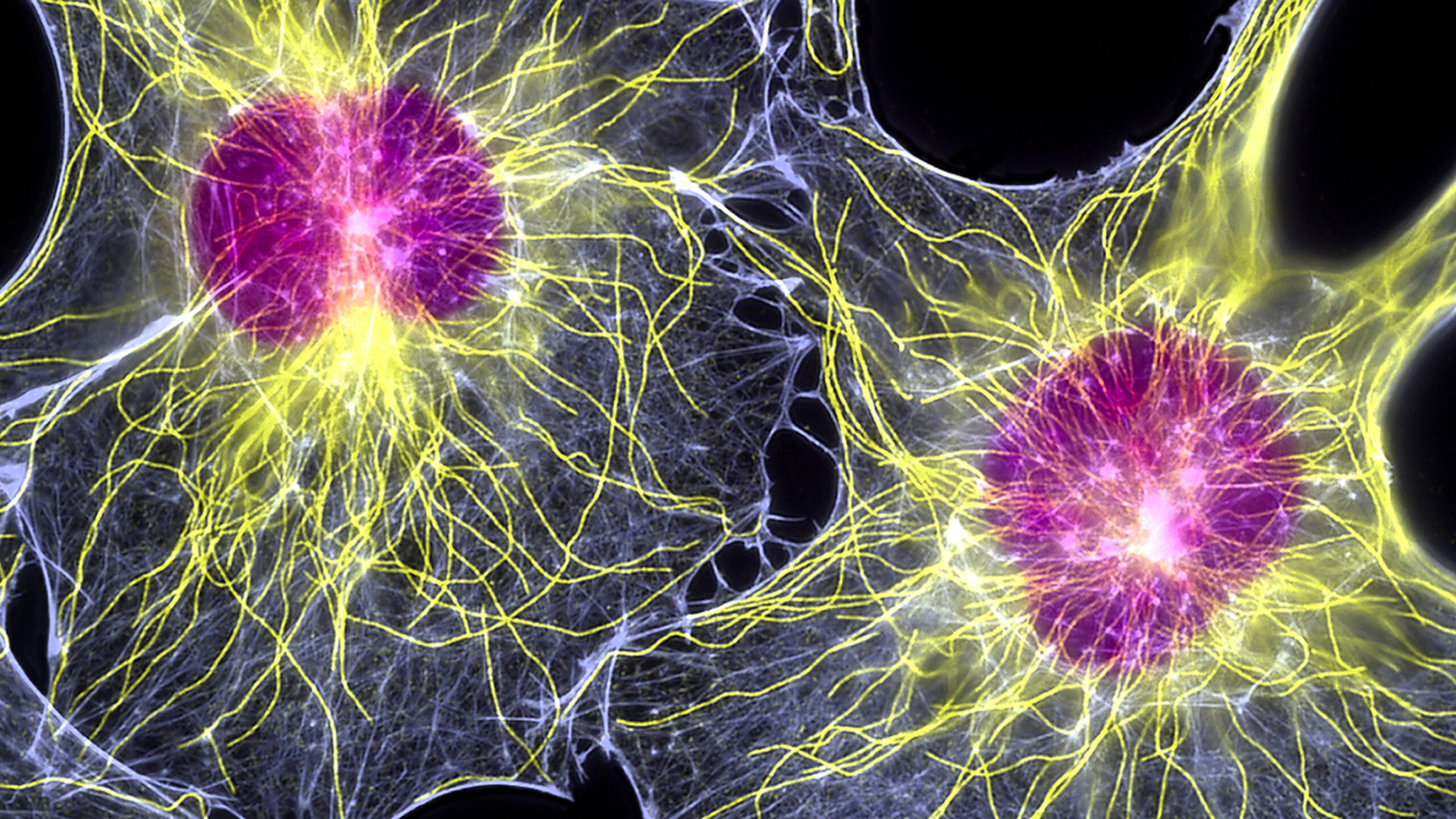 Image: Fibroblast cells representing anxiety disorders.